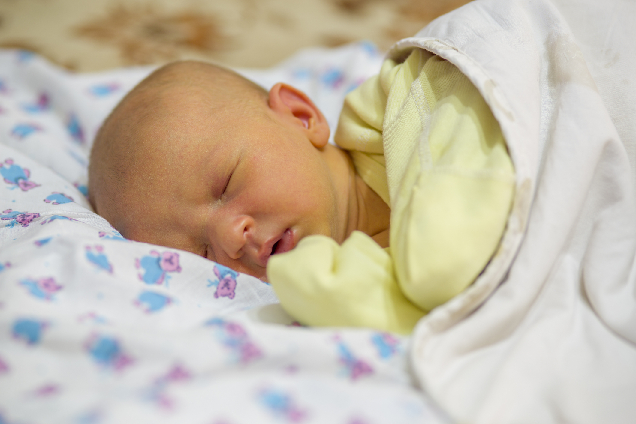 Icterícia no recém-nascido: o que é? Causas e tratamento | Vida Saudável | Conteúdos produzidos pelo Hospital Israelita Albert Einstein