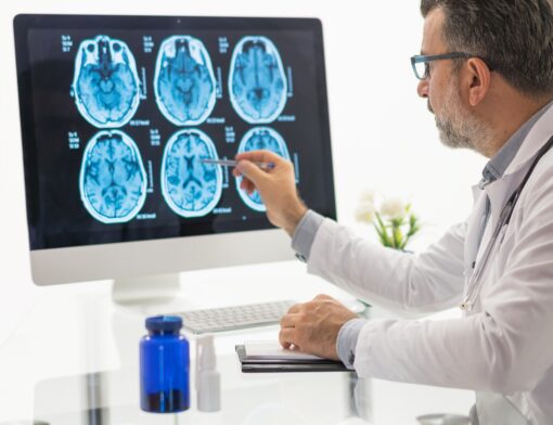 Saiba aqui quais são as principais causas dos tumores cerebrais