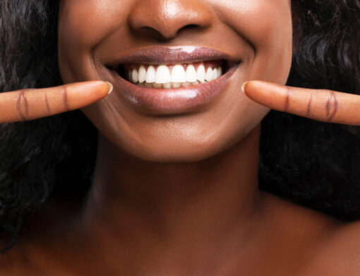 Lente de contato dental: conheça os prós e contras das facetas