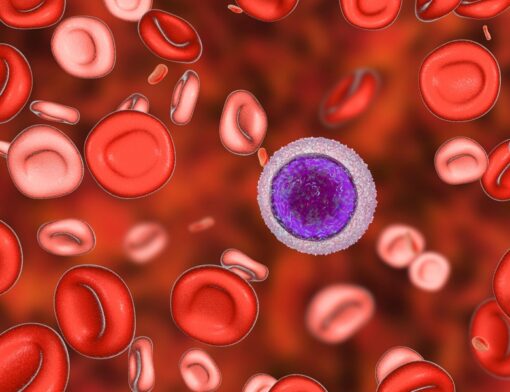 Você sabe identificar os sintomas da leucemia? Conheça os sinais que podem indicar essa doença e fique atento à sua saúde.