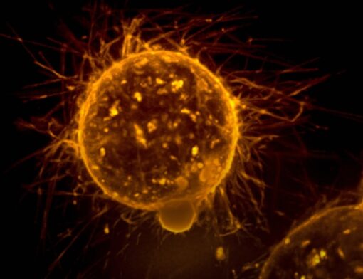 Célula cancerígena em destaque, ilustrando a importância da teranóstica na identificação de características tumorais para tratamentos mais eficazes.