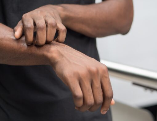 A dermatite atópica pode ser desencadeada por fatores ambientais. Conhecer esses elementos é essencial para o controle da condição.