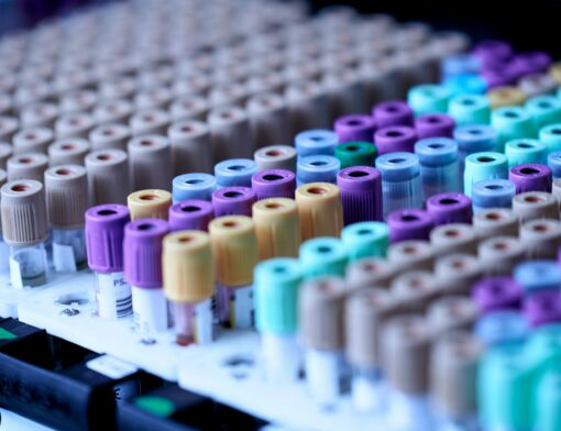 Tubos de coleta de sangue categorizados por diferentes cores